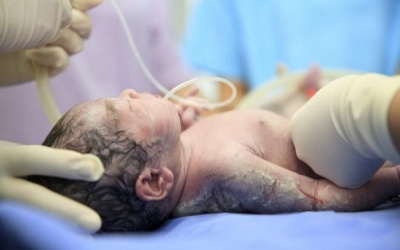 Cắt dây rốn muộn, trẻ thông minh hơn