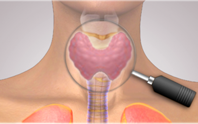 Những bệnh tuyến giáp thường gặp và cách phòng ngừa