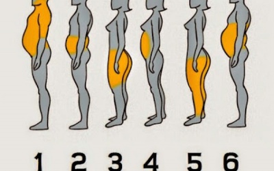 Ăn ít vẫn béo phì, phải làm sao?