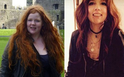 Ung thư trầm trọng vì giảm cân đột ngột