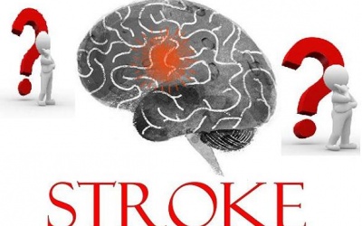 6 dấu hiệu cảnh báo cơn đột quỵ dễ bị bỏ qua 