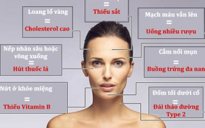 Nhìn sắc mặt, đoán bệnh tật!