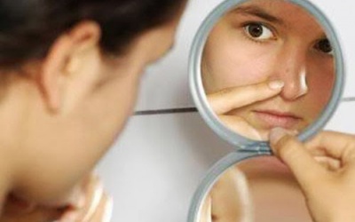 Có nên dùng thuốc nội tiết tố để trị mụn?