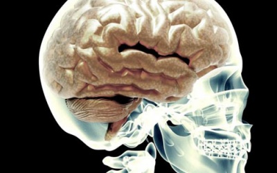 Đau chân, đến bệnh viện phát hiện còn nửa bộ não