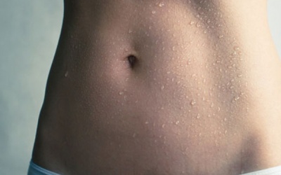 Mồ hôi tiết lộ bệnh tật