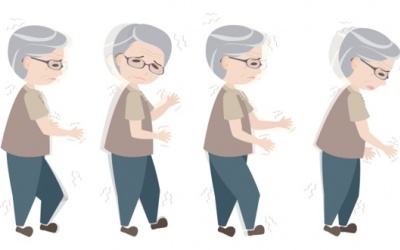 Bệnh Parkinson và run vô căn có phải là một?