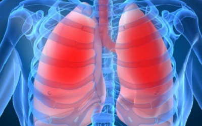 Người già mắc bệnh phổi: Cẩn thận kẻo ngã!