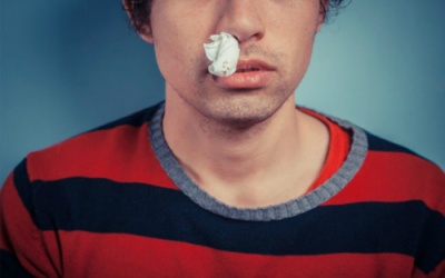 Chảy máu cam nghiêng đầu ra sau, nguy hiểm khó lường!