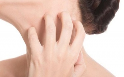 9 phương pháp tuyệt vời chữa ngứa da tại nhà
