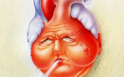 Dấu hiệu cảnh báo bệnh suy tim trở nặng