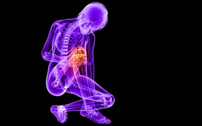 'Giả gout' là bệnh gì?