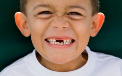 Khi nào cha mẹ nên nhổ răng sữa cho bé?