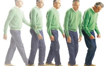 10 quan niệm “sai lè” về bệnh Parkinson