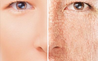 Phiền não vì da khô ráp khi mãn kinh