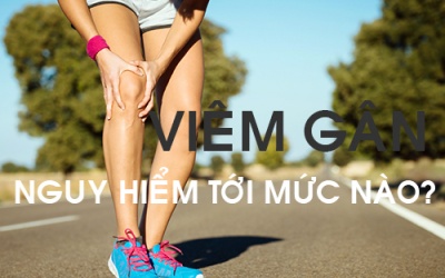 Tàn phế, què quặt vì bỏ qua những dấu hiệu viêm gân