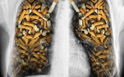 10 cách đơn giản giúp làm sạch phổi cho người hút thuốc