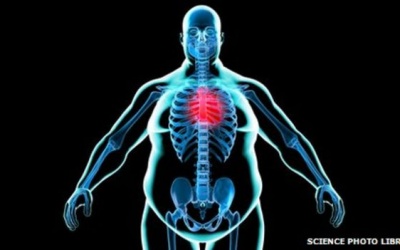 Trái tim không 'ưa' người mập!