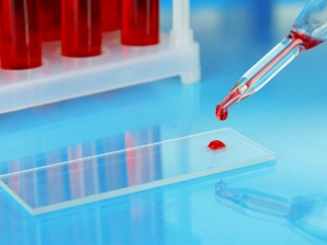 8 cách cải thiện chất lượng máu trong cơ thể