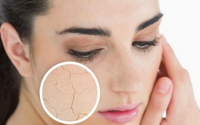 Những nguyên nhân hàng đầu gây khô da và cách khắc phục