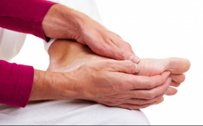 Top 10 biện pháp tự nhiên giúp giảm đau do gout