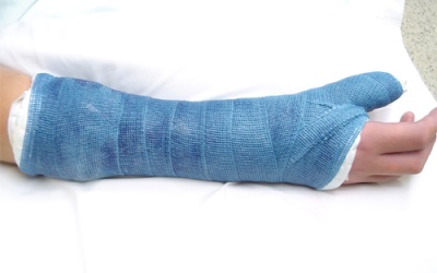 Bị gãy xương nên ăn gì để mau lành?