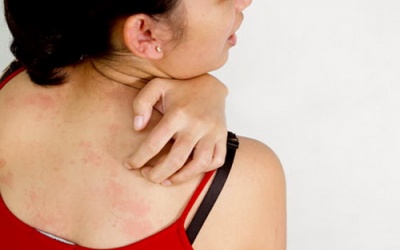 Biến chứng da đái tháo đường: Bạn đã biết?