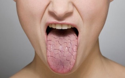 Video: Bí quyết đơn giản giúp hết khô miệng