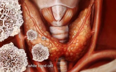 Cách giảm triệu chứng bệnh tự miễn bằng acid béo