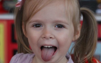 Viêm họng liên cầu khuẩn: Chần chừ điều trị, hối hận cả đời