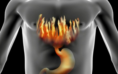 Ợ nóng quá 2 lần mỗi tuần - phải khám bác sỹ ngay!