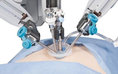 Cắt túi mật nội soi - Phương pháp điều trị dứt điểm sỏi mật