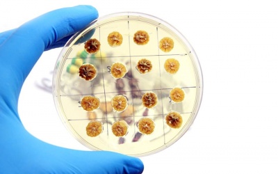 Infographic: Vi khuẩn kháng kháng sinh lây lan như thế nào?