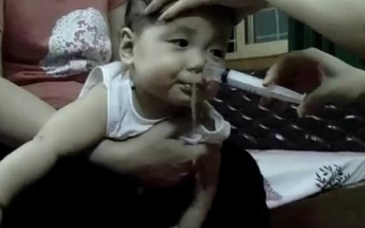Có nên hút rửa mũi cho trẻ bằng ống xilanh?