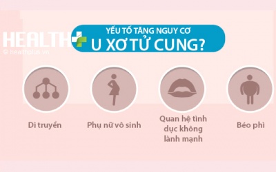 Con gái phải phòng tránh thế nào khi có mẹ mắc u xơ tử cung?