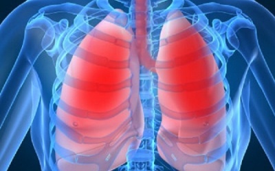 Video: Các triệu chứng của bệnh ung thư phổi