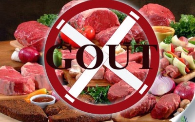 4 loại thực phẩm và đồ uống bệnh nhân gout nên tránh