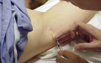 Có nên tiêm botox trị tăng tiết mồ hôi?