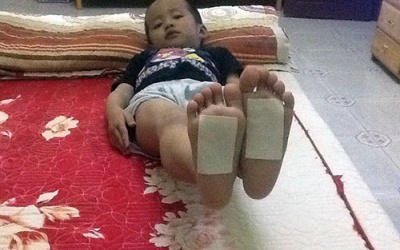 Có nên chữa ho cho trẻ bằng tinh dầu, dán cao vào huyệt Dũng tuyền?