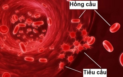 Xét nghiệm máu thấy tiểu cầu giảm nhanh có nghĩa là gì?