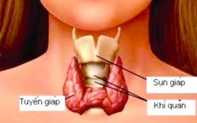 Những thực phẩm ảnh hưởng trực tiếp đến tuyến giáp