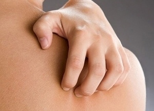 Ngứa, nổi mụn, nổi chàm lưng vào mùa Đông là bệnh gì?