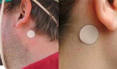 Hệ quả khôn lường khi dùng miếng dán chống say xe sai cách