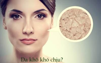 Tự chế mặt nạ - cứu làn da khô mốc
