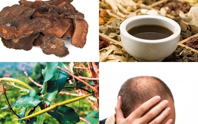 Chết vì suy gan do dùng hà thủ đô đỏ trị hói đầu sai cách