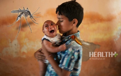 Infographic: Phòng ngừa và điều trị bệnh do virus Zika