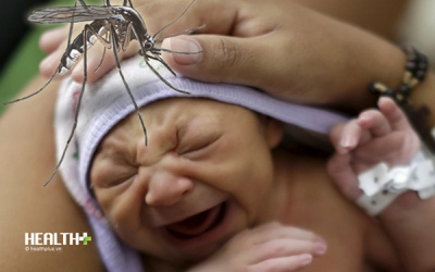 Infographic: Bạn đã biết gì về dịch bệnh Zika teo não trẻ?