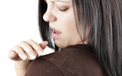 6 điều kinh khủng mà gàu có thể gây ra cho bạn