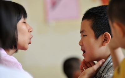 Trẻ nói ngọng: Cẩn thận nhiều bệnh lý nguy hiểm