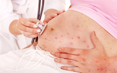 Mẹ bị thủy đậu, thai nhi có bị ảnh hưởng?