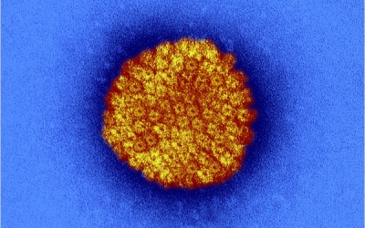 Mụn cóc sinh dục cũng gây... mất trí nhớ?